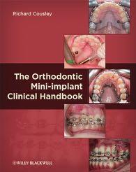 It provides the essential theoretical and clinical mini implant information to enable the clinician to easily introduce