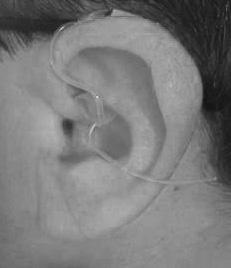 over your ear. Inserting ear tube & tip 1.