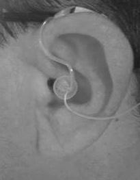 into your ear canal. 2.