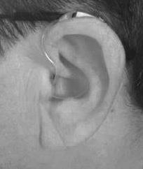 ear. The retention loop will tuck in easily, as body