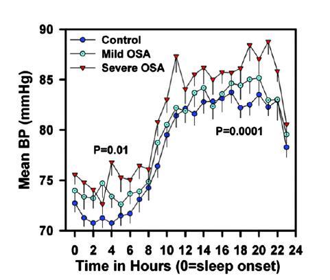 Blood pressure in pediatric OSA blood pressure and heart rate changes during obstructive events (similar in magnitude in adults) (O Driscoll, 2009) a strong,