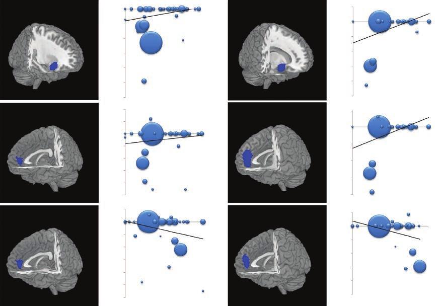 Wang et al. frontoinsular cortex were associated with bipolar disorder and bipolar disorder type I patients.