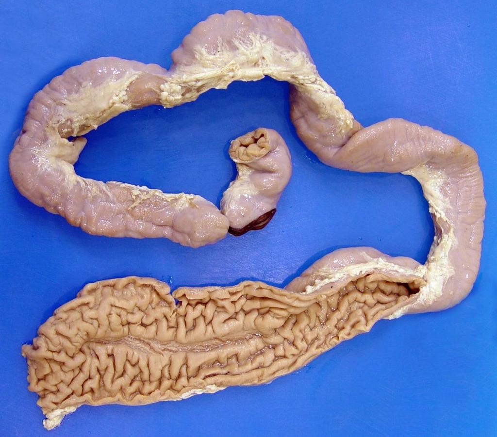 Pathology of the Alimentary Tract Case 2b Adult cow with