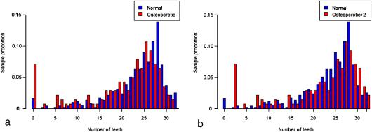 192 Nicopoulou-Karayianni et al. Fig. 1. (a ) Histogram of tooth count for osteoporotic group (red) and that for normal group (blue).