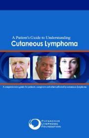New Patient s Guide to Understanding Cutaneous Lymphoma Hot Off The Press: The Cutaneous Lymphoma Foundation's New Patient's Guide to Understanding Cutaneous Lymphoma It s finally here!