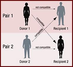 Approach to sensitized patients Patients without living donor Patients with a living donor Allocation System No DSA & Negative Cross-match DSA & Positive