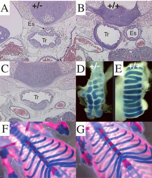 2400 M. Mahlapuu, S. Enerbäck and P. Carlsson Fig. 2. Foregut, respiratory tract and skeletal malformations in Foxf1 +/ embryos.