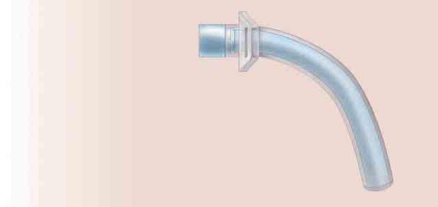 Your Trach Tube Your trach tube is designed to help you breathe. Read on to learn the parts of your trach tube and what they do.