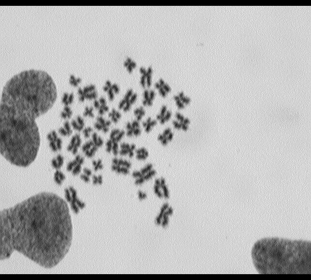 Chromosome aberrations/in 100 cells CSA