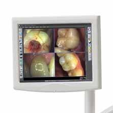 Extra-oral Vision: grabs a smile to add to patient records. LCD flat-screen 15 monitor that complies with EC Medical Device directive 93/42. The anti-glare 3.