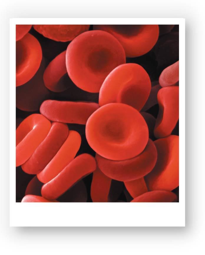 Figure 19-2b The Anatomy of Red Blood Cells.