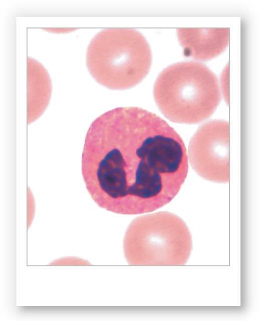 Figure 19-9b White Blood
