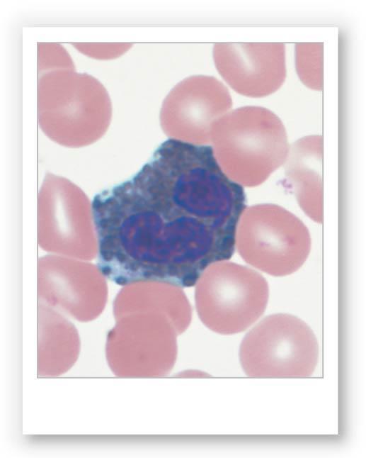 Figure 19-9c White Blood