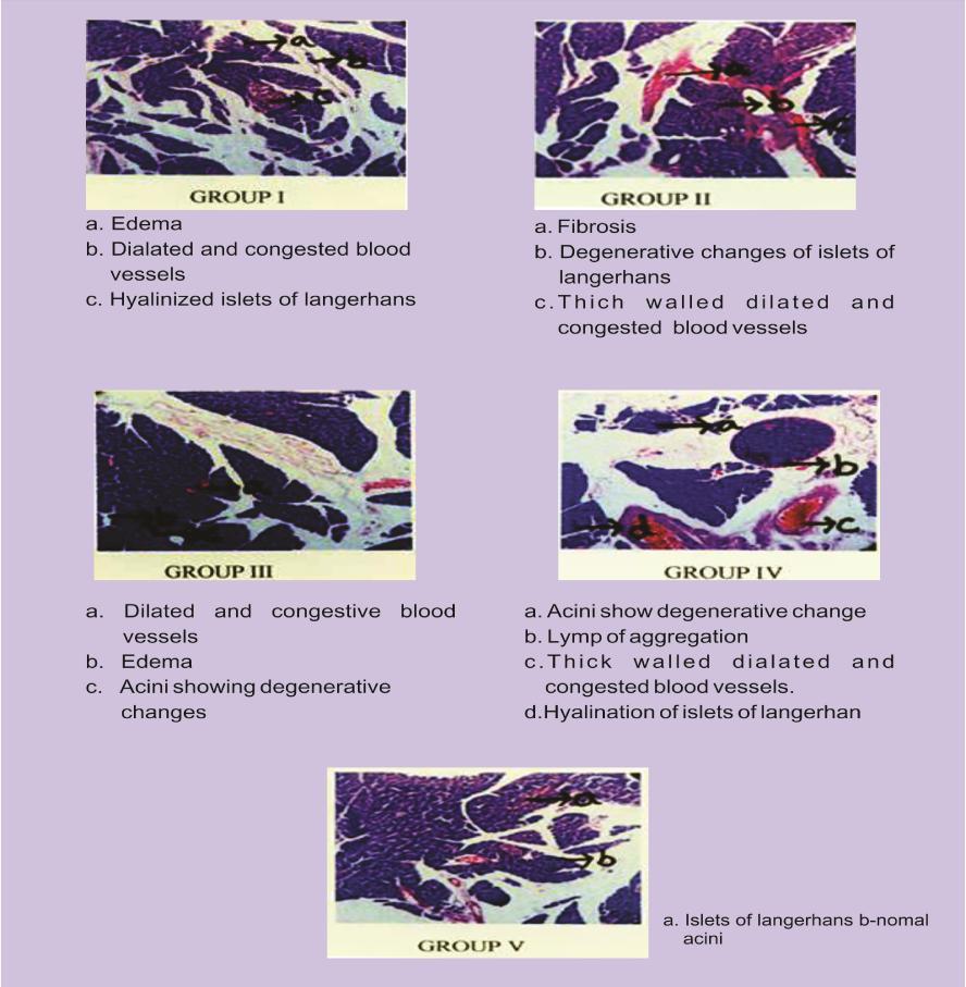 190 Suriya Annamalai. et al., Int. J. Pharm. & H. Care Res., Vol. 02 (03) 2014 [184-191] Fig. No. 05: Histopathology of pancreas % of inhibition 1.5 1.0 0.5 EECS STD 0.