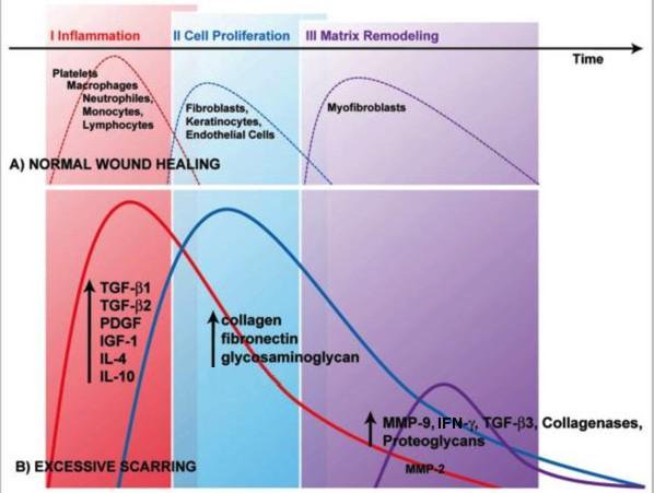 Figure 1-2: Brief overview of the differences between the phases of normal wound healing and excessive scar formation [10]
