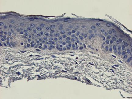 (d) In the higher magnification of immunostaining