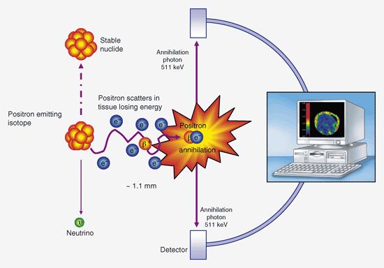 Positron Emission Tomography PET - nuclear medicine imaging technique that produces a 3D image or picture of functional processes in the body