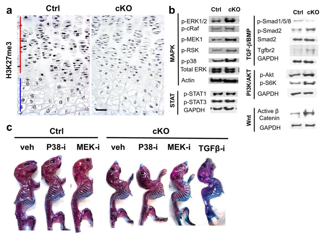 Supplementary Figure 2 (Related with Figures 1,4,5 and 6). (a) Immunostaining for H3K27me3 on tibial growth plate sections of wild type (Ctrl) and Eed cko (cko) mice.