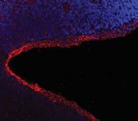 Cili stining in Ahi1 mutnt cereellr neurons.