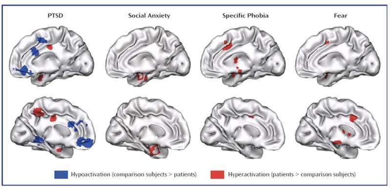 Some brain areas (amygdala, insula) are hyperactive (red) across phobias, social anxiety, and PTSD
