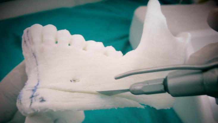 After the markings were placed, mock surgery was performed by placing the osteotomies using an oscillating saw.