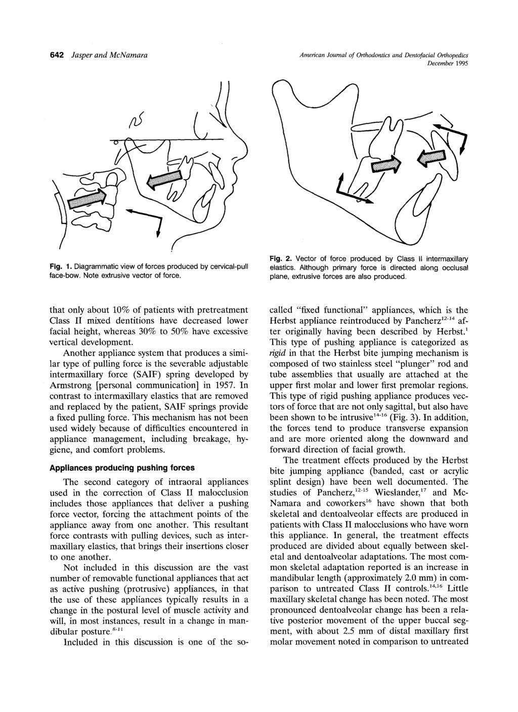 642 Jasper and McNamara American Journal of Orthodontics and Dentofacial Orthopedics December 1995 :-.'.:.'.!3:-. Fig. 1. Diagrammatic view of forces produced by cervical-pull face-bow.