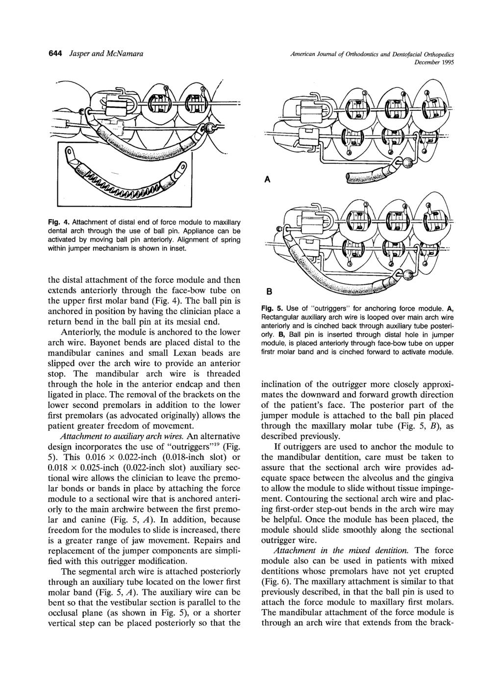 644 Jasper and McNamara American Journal of Orthodontics and Dentofacial Orthopedics December 1995 Fig 4 Attachment of distal end of force module to maxillary dental arch through the use of ball pin.