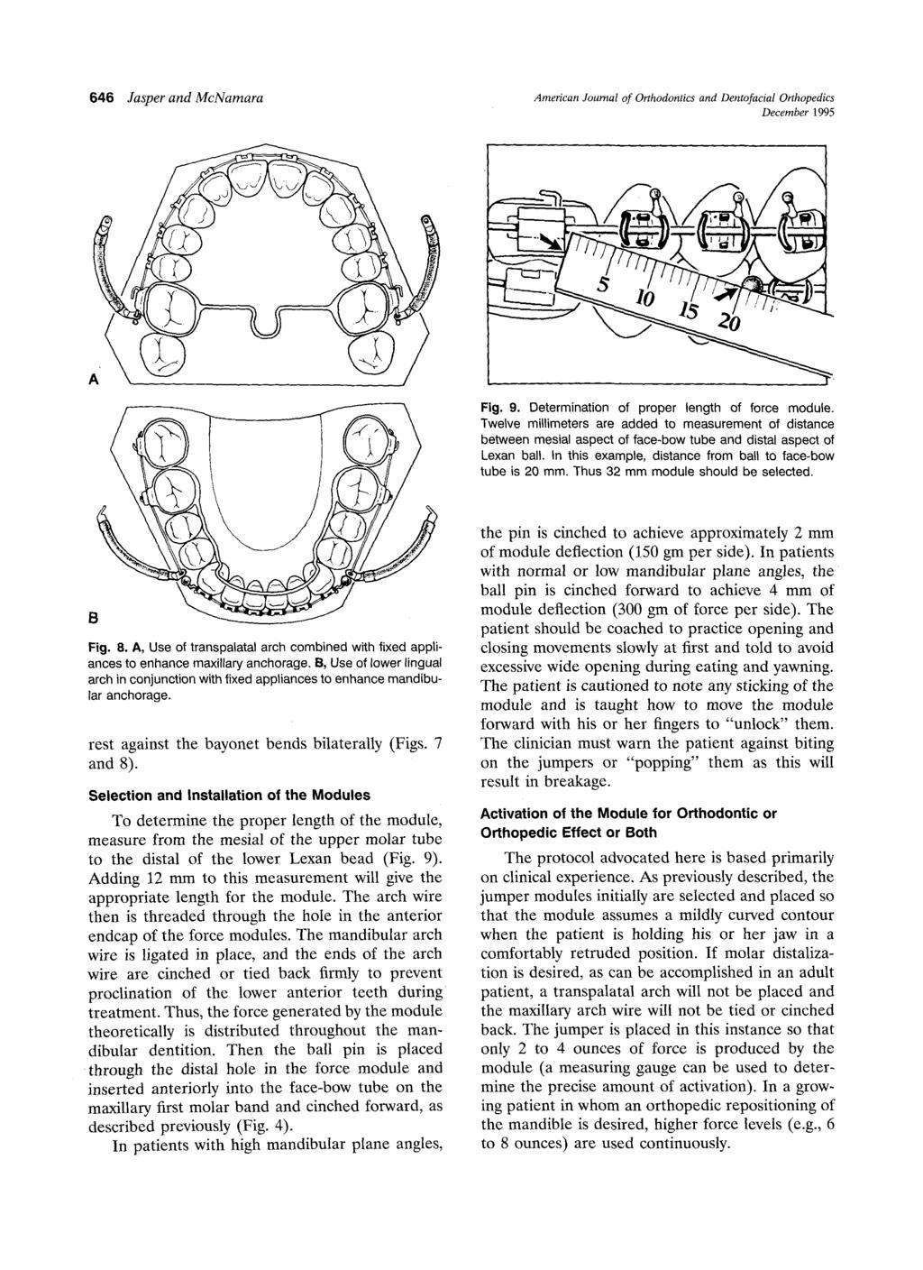 646 Jasper and McNamara American Journal of Orthodontics and Dentofacial Orthopedics December 1995 - - z O Fig. 9. Determination of proper length of force module.