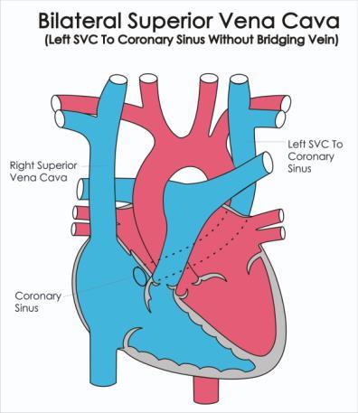 SVC Anatomy