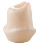 The template can be imposed on the scan of the Variobase Abutment model via a matching process.