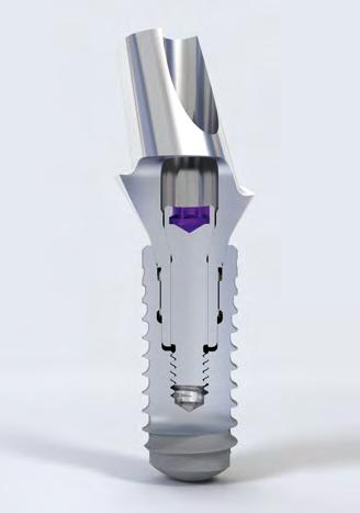2. ORIGINAL STRAUMANN IMPLANT-ABUTMENT CONNECTION THE PERFECT MATCH IN EVERY RESPECT ORIGINAL STRAUMANN COMPONENTS ARE THE RECOMMENDED CHOICE YOUR DECISION FOR ORIGINAL STRAUMANN COMPONENTS IS