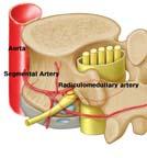 herniations by