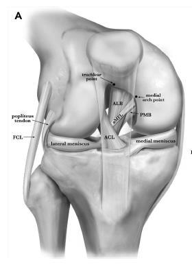 Anatomy Anterior View Posterior View Lateral aspect of medial femoral condyle to posterior