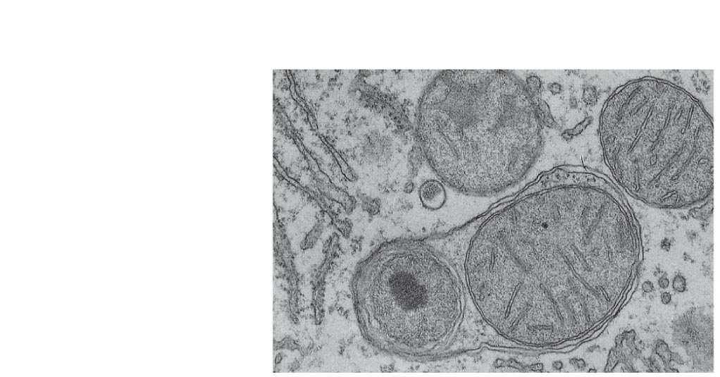 Fig. 6-14b Vesicle containing two damaged