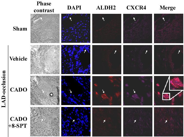 Adenosine stimulates EPC recruitment to the infarcted heart CXCR4 and ALDH2 stainings Weak