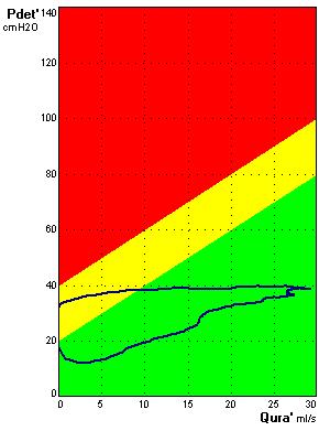 From: Detrusor pressure Flow rate To: Urethral resistance Bladder