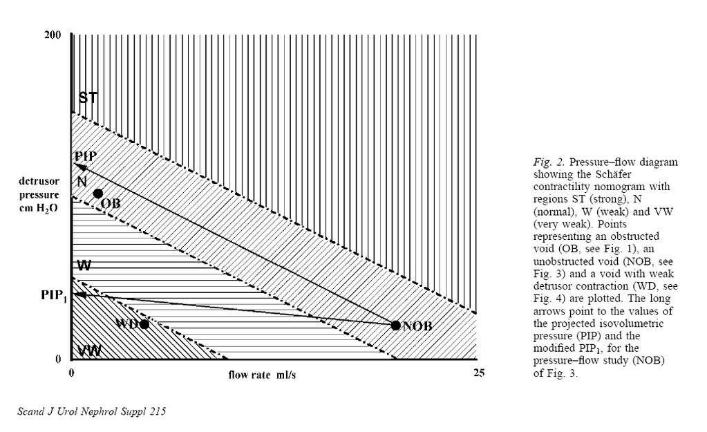 Detrusor pressure P isv Flow rate DJ Griffiths: Detrusor contractility order out of chaos. Scand J Urol Nephrol Suppl 215: 93-100, 2004.