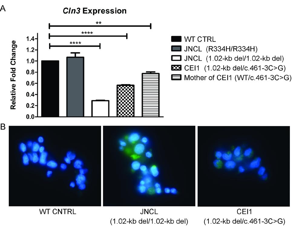 efigure 4. Evaluation of the effect of intronic mutation c.461-3c>g on CLN3 transcript level and autofluorescent phenotype (A) CLN3 transcript levels in patient CEI1 (1.02-kb deletion/c.