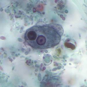 The ingested erythrocyte appears as a dark inclusion.