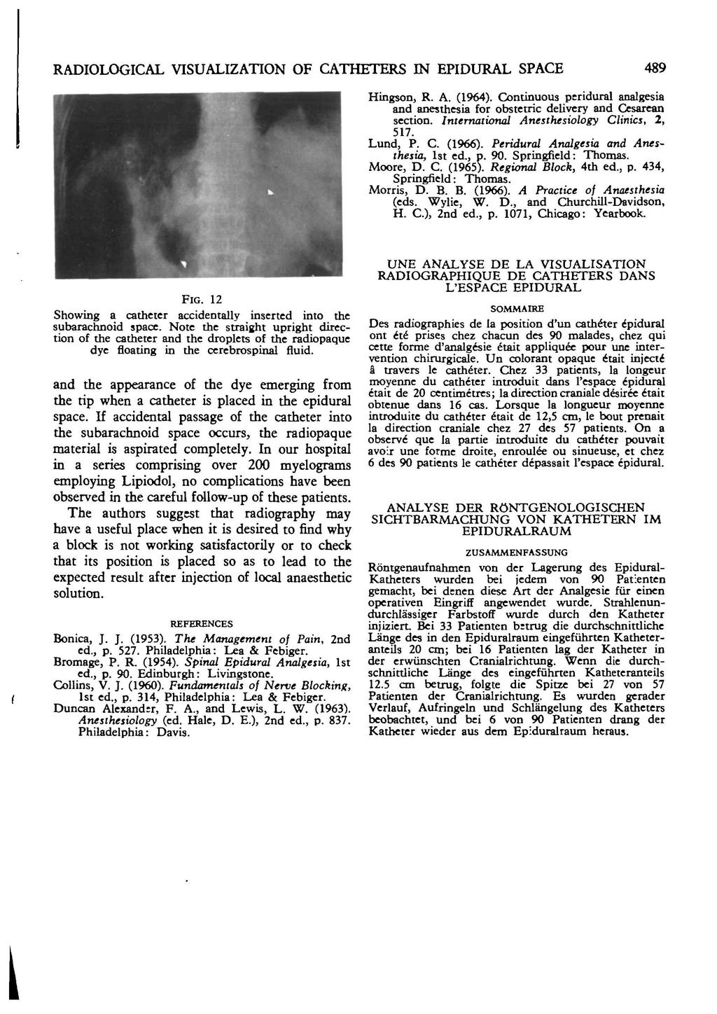 RADIOLOGICAL VISUALIZATION CATHETERS IN EPIDURAL SPACE 489 Hingson, R. A. (1964). Continuous peridural analgesia and anesthesia for obstetric delivery and Cesarean section.