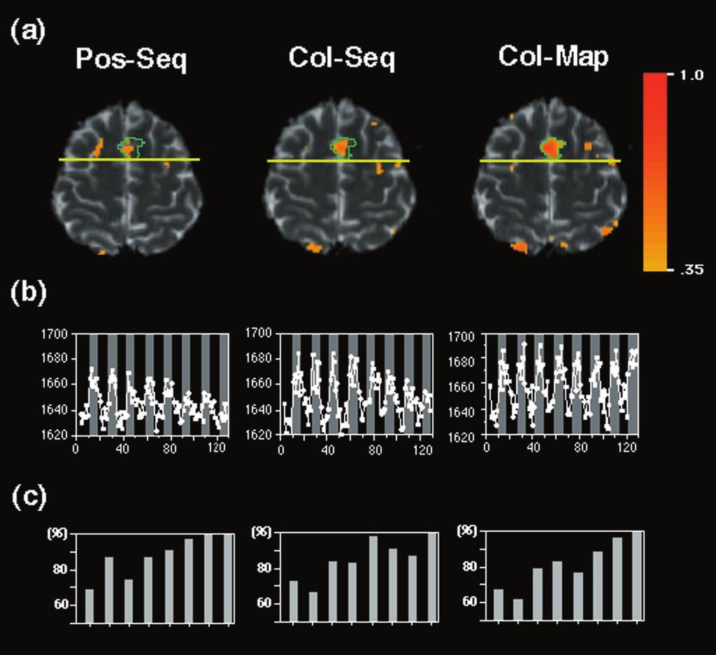4 J. Neurosci., 1999, Vol. 19 Sakai et al. Pre-SMA and Visuo-Motor Association Figure 3. a, Activation maps from a representative single subject. The right hemisphere is shown on the left.
