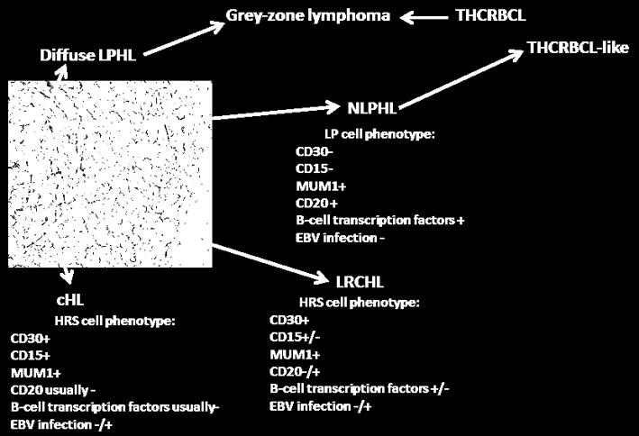 Host Hodgkin lymphoma subtype EBV infection HL of the general population Immunodeficiency-associated HL HIV-associated HL Nodular lymphocyte predominance - chl, nodular sclerosis Usually -* chl,