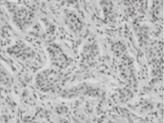 Immunostaining results of