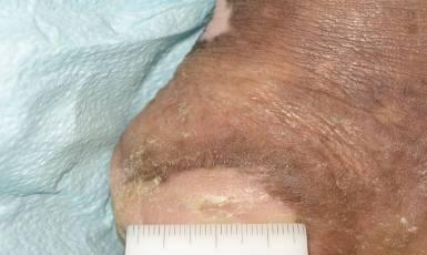 patient treated with