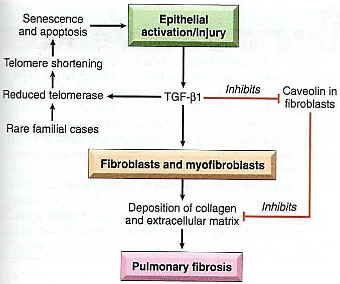 Idiopathic pulmonary fibrosis (Usual interstitial pneumonia)