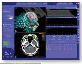 Multi-Plan TPS An intuitive workflow-based treatment planning software designed for radiosurgery Enables excellent conformality and coverage with steep dose gradients.