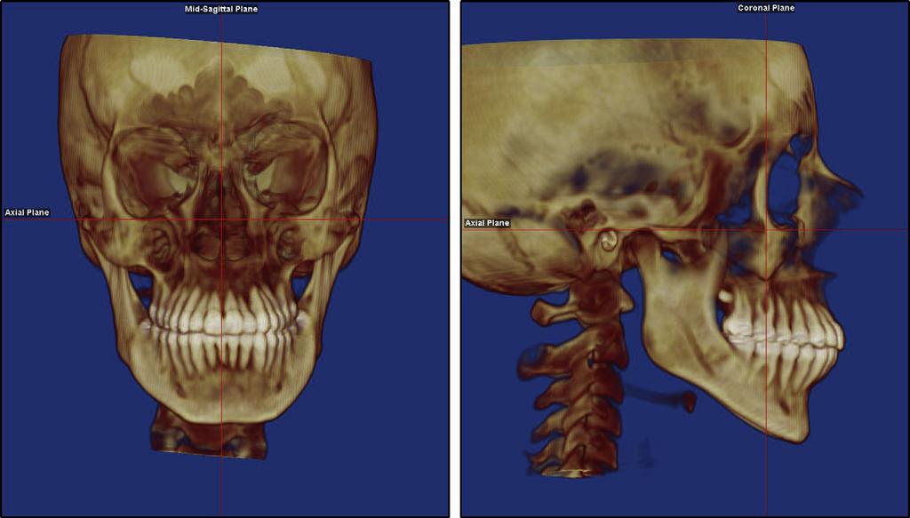 Smith et al 623 Fig 7. Image orientations: frontal and sagittal views.