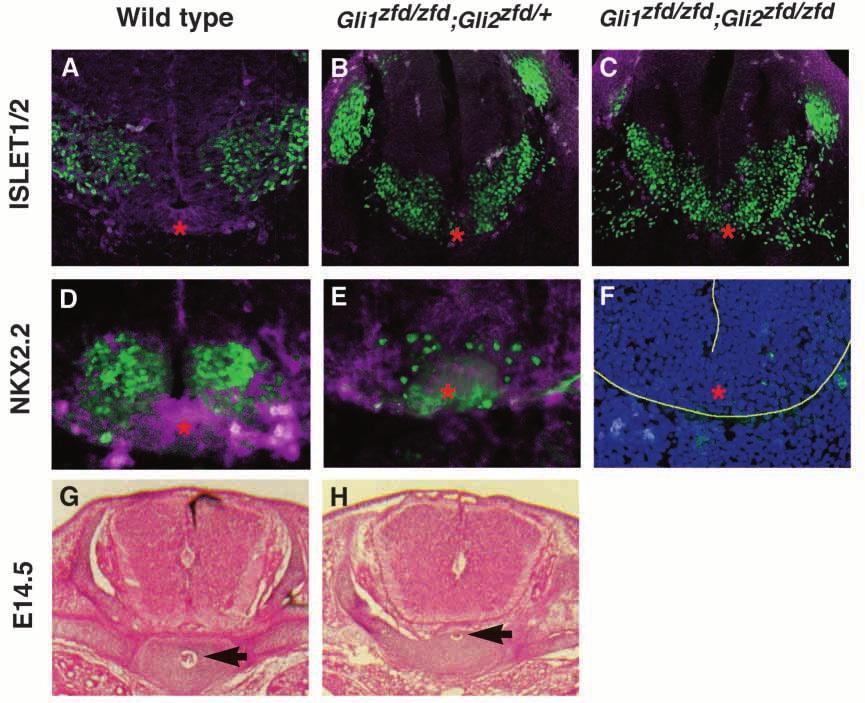1600 H. L. Park and others Fig. 4. Gli1 zfd/zfd ;Gli2 zfd/+ mice have a variable loss of ventral midline cells in the developing spinal cord at E10.5 and have a defect in notochord regression. At E10.