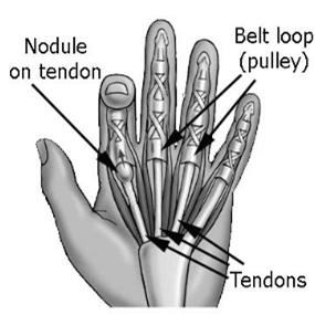 #10 Question A 56 year old female presents to your office with pain on the palmar aspect of her hand just proximal to the first knuckle of the index and middle fingers.