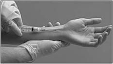 side of wrist Gradual onset Worsening pain with movement or activity Tenderness to palpation over radial side
